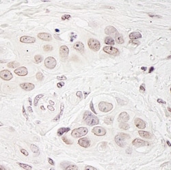 Breast carcinoma amplified sequence 3 Antibody, Novus Biologicals 0.1mL;
